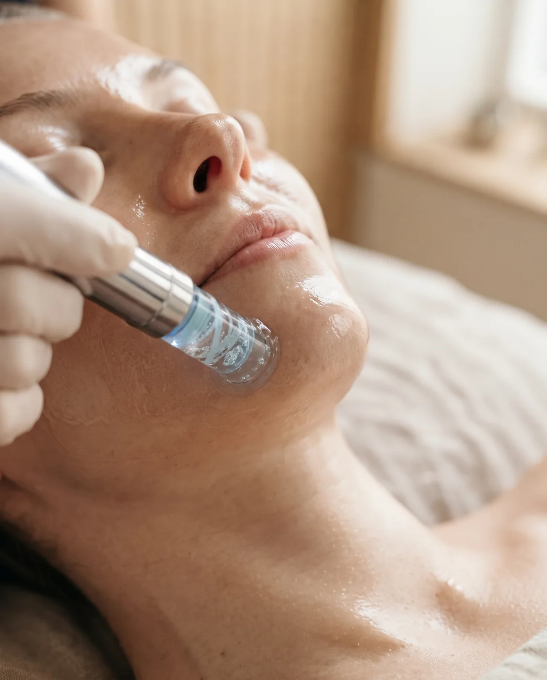 Hydrapeel · course of 3